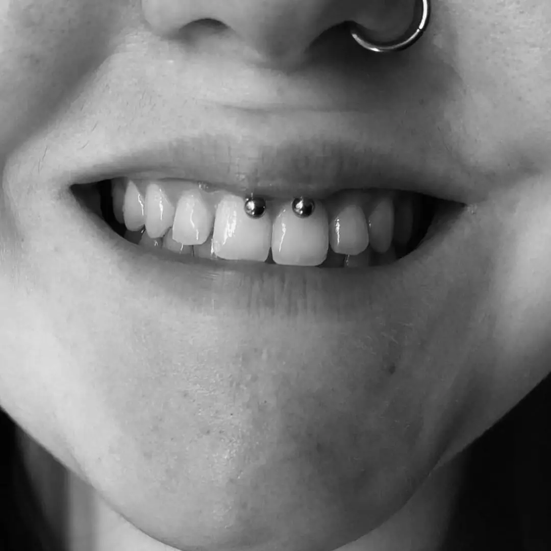 Smiley piercing