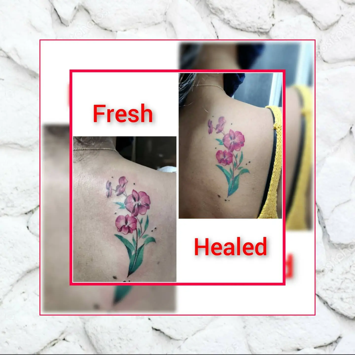What Are The Three Stages Of The Recovery Process For A Tattoo?
