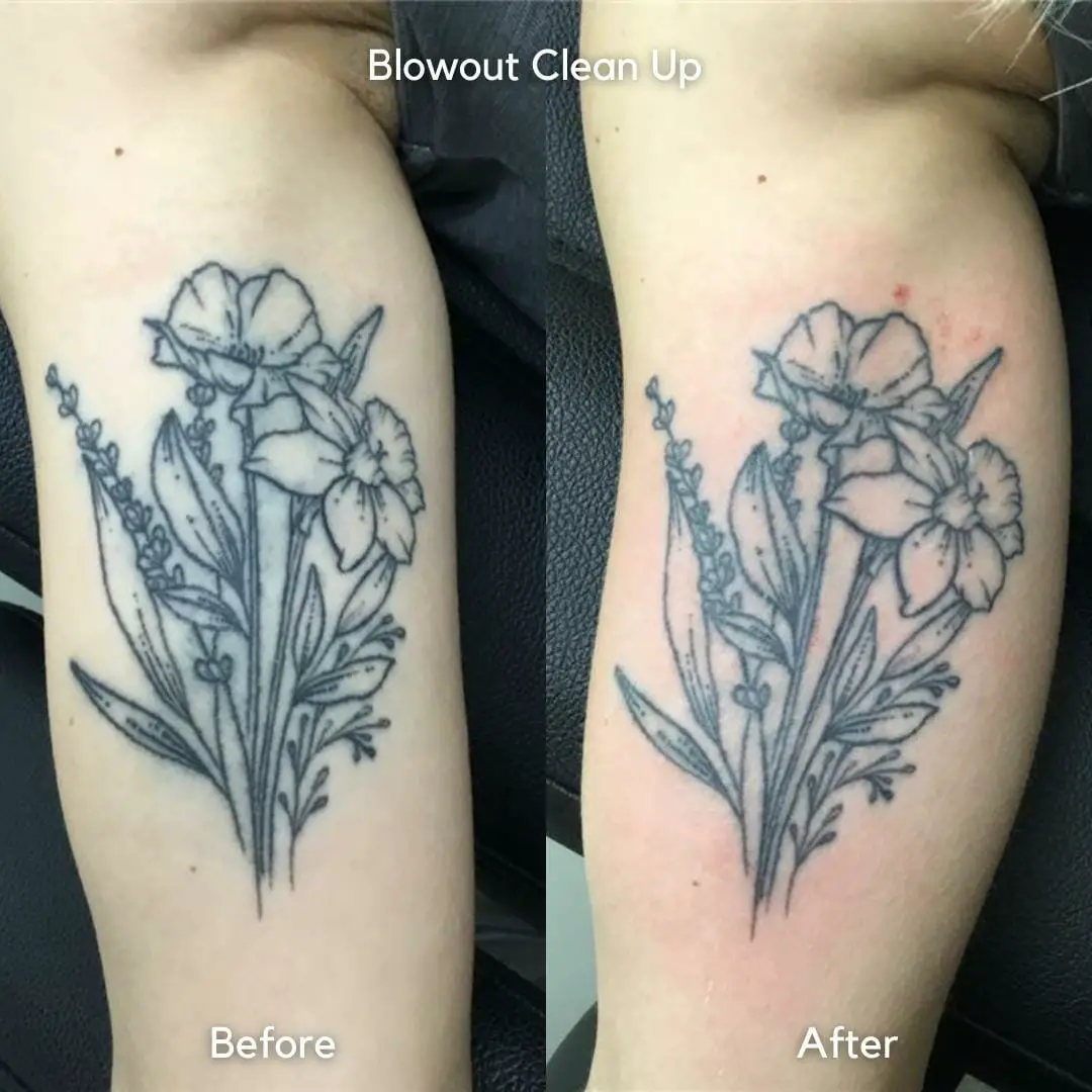 Tattoo Blowout: Causes And Preventions - Psycho Tats
